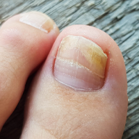 DERMATOLOŠKE INFORMACIJE!