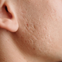 DERMATOLOŠKE INFORMACIJE!