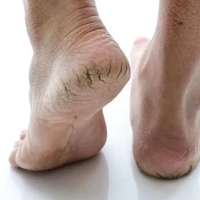 DERMATOLOŠKE INFORMACIJE!