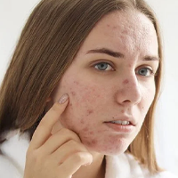 DERMATOLOŠKE INFORMACIJE!