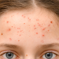 DERMATOLOŠKE INFORMACIJE!