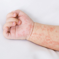 DERMATOLOŠKE INFORMACIJE!
